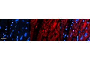Rabbit Anti-MRPS15 Antibody    Formalin Fixed Paraffin Embedded Tissue: Human Adult heart  Observed Staining: Nuclear, Cytoplasmic Primary Antibody Concentration: 1:600 Secondary Antibody: Donkey anti-Rabbit-Cy2/3 Secondary Antibody Concentration: 1:200 Magnification: 20X Exposure Time: 0. (MRPS15 antibody  (N-Term))