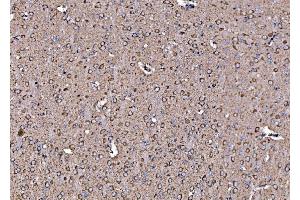 IHC analysis of DLAT using anti-DLAT antibody (ABIN7602307).