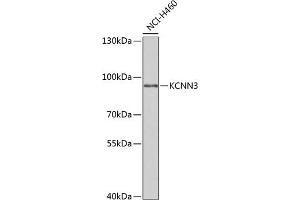 Western blot analysis of extracts of NCI-H460 cells, using KCNN3 antibody (ABIN6131840, ABIN6142769, ABIN6142771 and ABIN6221723) at 1:1000 dilution. (KCNN3 antibody  (AA 237-426))