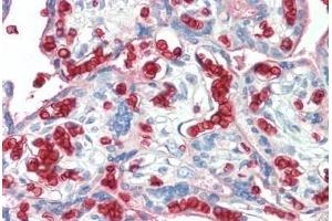 Human Placenta: Formalin-Fixed, Paraffin-Embedded (FFPE) (Erythrocytes antibody)