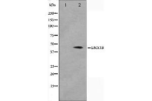 Western blot analysis on Jurkat cell lysate using LMX1B Antibody,The lane on the left is treated with the antigen-specific peptide. (LMX1B antibody  (Internal Region))