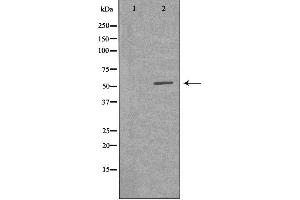 Western blot analysis of extracts from Jurkat cells, using VRK2 antibody. (VRK2 antibody  (Internal Region))