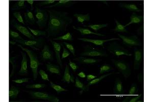 Immunofluorescence of monoclonal antibody to RPS6KA6 on HeLa cell. (RPS6KA6 antibody  (AA 636-745))