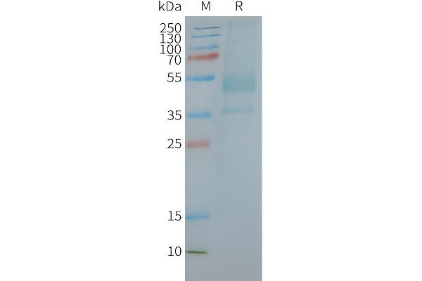 CXCR2 Protein