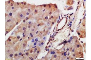 Formalin-fixed and paraffin embedded mouse pancreas labeled with Anti-HDAC8 Polyclonal Antibody, Unconjugated  at 1:200 followed by conjugation to the secondary antibody and DAB staining. (HDAC8 antibody  (AA 151-250))