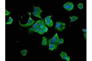 Immunofluorescence staining of MCF-7 cells with ABIN7154923 at 1:66, counter-stained with DAPI. (HSP9AB1 (AA 150-355) antibody)