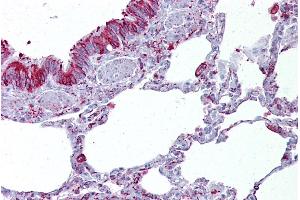 Immunohistochemistry with Lung tissue at an antibody concentration of 5µg/ml using anti-GABRB3 antibody (ARP35339_P050) (GABRB3 antibody  (Middle Region))