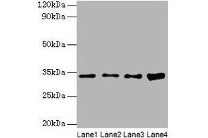 Western blot All lanes: GTF2E2 antibody at 2 μg/mL Lane 1: Mouse brain tissue Lane 2: Hela whole cell lysate Lane 3: MCF-7 whole cell lysate Lane 4: PC-3 whole cell lysate Secondary Goat polyclonal to rabbit IgG at 1/10000 dilution Predicted band size: 34 kDa Observed band size: 34 kDa (GTF2E2 antibody  (AA 1-291))