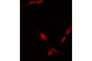 ABIN6274402 staining HuvEc by IF/ICC. (TNFAIP8L2 antibody  (Internal Region))