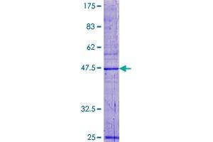 Image no. 1 for Processing of Precursor 5, Ribonuclease P/MRP Subunit (POP5) (AA 1-163) protein (GST tag) (ABIN1315752)