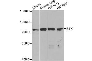 Western blot analysis of extracts of various cell lines, using BTK antibody. (BTK antibody)
