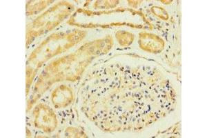 Immunohistochemistry of paraffin-embedded human kidney tissue using ABIN7172224 at dilution of 1:100 (TM2D3 antibody  (AA 31-153))