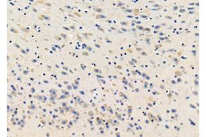 ABIN6265432 and ABIN6278417 at 1/100 staining Mouse brain tissue by IHC-P.