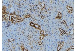 ABIN6278837 at 1/100 staining Mouse kidney tissue by IHC-P.