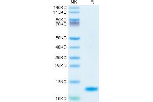 Human IL-8 on Tris-Bis PAGE under reduced condition. (IL-8 Protein (AA 28-99) (His tag))