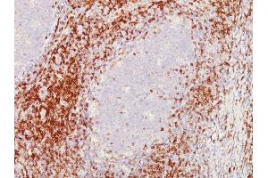 Formalin-fixed, paraffin-embedded human Tonsil stained with CD5 Mouse Monoclonal Antibody (C5/473 + CD5/54/F6) (CD5 antibody)