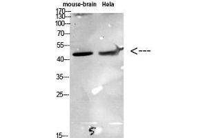 Western Blot (WB) analysis of specific cells using Antibody diluted at 1:1000. (CKR-6 antibody)