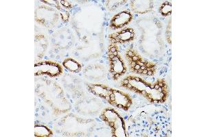 Immunohistochemistry of paraffin-embedded mouse kidney using α-Tubulin Mouse mAb (ABIN7271035) at dilution of 1:100 (40x lens). (TUBA4A antibody)