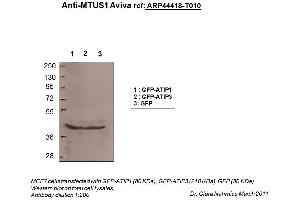 Image no. 2 for anti-Microtubule Associated Tumor Suppressor 1 (MTUS1) (N-Term) antibody (ABIN310597) (MTUS1 antibody  (N-Term))