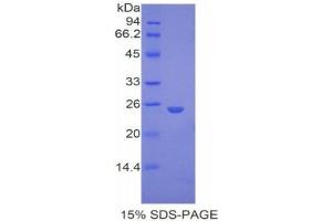 SDS-PAGE (SDS) image for Glypican 4 (GPC4) (AA 220-426) protein (His tag) (ABIN2121151)