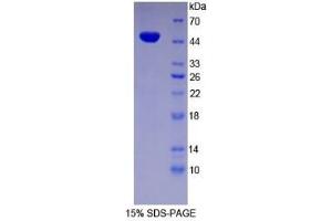 SDS-PAGE of Protein Standard from the Kit  (Highly purified E. (ENO2/NSE ELISA Kit)
