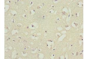 Immunohistochemistry of paraffin-embedded human brain tissue using ABIN7145556 at dilution of 1:100 (BFAR antibody  (AA 1-140))