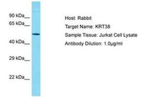 Image no. 1 for anti-Keratin 38 (KRT38) (AA 94-143) antibody (ABIN6750575) (KRT38 antibody  (AA 94-143))