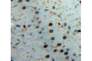 Used in DAB staining on fromalin fixed paraffin-embedded Brain tissue (IL-33 antibody  (AA 1-270))