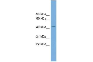 WB Suggested Anti-AP1M2  Antibody Titration: 0. (AP1m2 antibody  (N-Term))