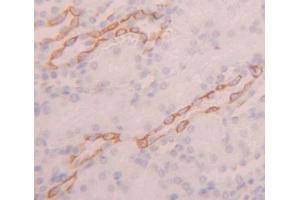Used in DAB staining on fromalin fixed paraffin- embedded kidney tissue (IL17D antibody  (AA 76-274))
