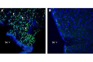Expression of C3aR1 in mouse hypothalamus. (C3AR1 antibody  (Extracellular))