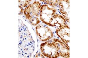 (ABIN390207 and ABIN2840690) staining DDIT4 in human kidney tissue sections by Immunohistochemistry (IHC-P - paraformaldehyde-fixed, paraffin-embedded sections). (DDIT4 antibody  (N-Term))