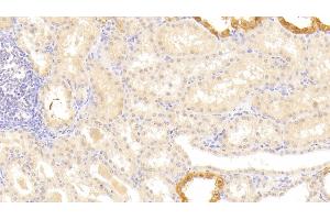 Detection of LAMb3 in Human Kidney Tissue using Polyclonal Antibody to Laminin Beta 3 (LAMb3) (Laminin beta 3 antibody  (AA 352-587))