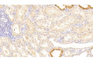 Detection of LAMb3 in Human Kidney Tissue using Polyclonal Antibody to Laminin Beta 3 (LAMb3) (Laminin beta 3 antibody  (AA 352-587))