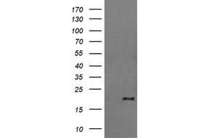 Image no. 2 for anti-Fetal and Adult Testis Expressed 1 (FATE1) antibody (ABIN1498226) (FATE1 antibody)