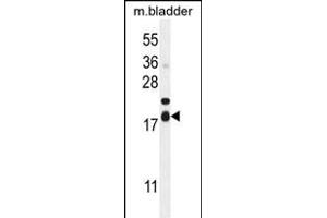 F162A Antibody (C-term) (ABIN654943 and ABIN2844584) western blot analysis in mouse bladder tissue lysates (35 μg/lane). (F162A antibody  (C-Term))