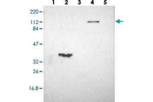 Western blot analysis of Lane 1: RT-4, Lane 2: U-251 MG, Lane 3: Human Plasma, Lane 4: Liver, Lane 5: Tonsil with FAM65A polyclonal antibody  at 1:250-1:500 dilution. (FAM65A antibody)