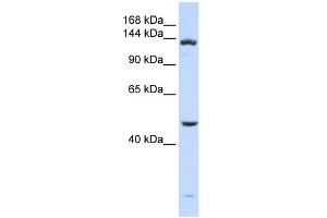 WB Suggested Anti-ADAMTS18 Antibody Titration: 0. (ADAMTS18 antibody  (N-Term))