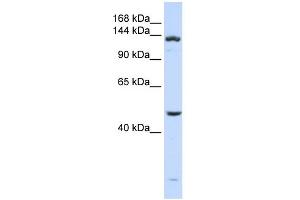 WB Suggested Anti-ADAMTS18 Antibody Titration: 0. (ADAMTS18 antibody  (N-Term))