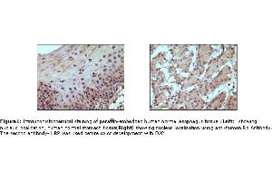 Image no. 1 for anti-Retinoblastoma Protein (Rb Protein) antibody (ABIN205594) (Retinoblastoma Protein (Rb) antibody)