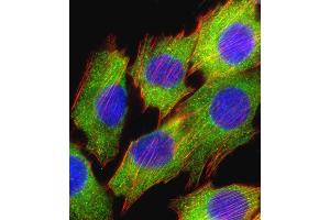 Fluorescent confocal image of C2C12 cell stained with AKT2 Antibody  (ABIN391024 and ABIN2841194).