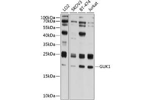 Western blot analysis of extracts of various cell lines, using GUK1 antibody (ABIN6133522, ABIN6141539, ABIN6141540 and ABIN6224743) at 1:1000 dilution. (GUK1 antibody  (AA 1-197))