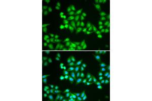 Immunofluorescence analysis of HeLa cells using CHD2 antibody. (CHD2 antibody)