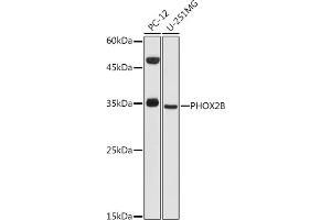 Western blot analysis of extracts of various cell lines, using PHOX2B antibody (ABIN6132489, ABIN6145577, ABIN6145578 and ABIN6225067) at 1:1000 dilution. (PHOX2B antibody  (AA 1-90))