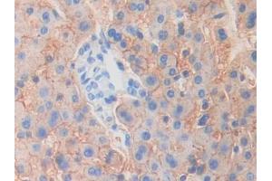 IHC-P analysis of Human Liver Tissue, with DAB staining. (MYO1G antibody  (AA 769-1016))