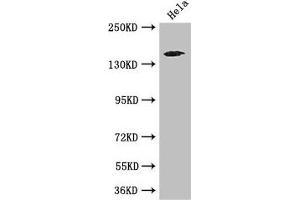 Western Blot Positive WB detected in: Hela whole cell lysate All lanes: TNRC6C antibody at 3.