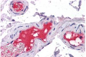 Vessels, Human: Formalin-Fixed, Paraffin-Embedded (FFPE) (PROC antibody)