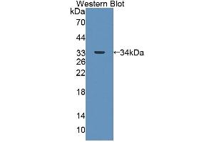 Detection of Recombinant ABAT, Mouse using Polyclonal Antibody to 4-Aminobutyrate Aminotransferase (ABAT) (ABAT antibody  (AA 236-500))