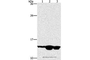 Western blot analysis of Mouse skin tissue, human fetal liver and fetal brain tissue, using HES5 Polyclonal Antibody at dilution of 1:100 (HES5 antibody)