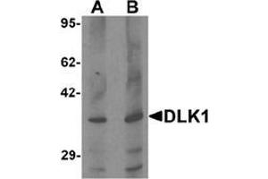 Western blot analysis of HepG2 in 293 cell lysate with DLK1 Antibody  at (A) 1 and (B) 2 μg/ml. (DLK1 antibody  (C-Term))
